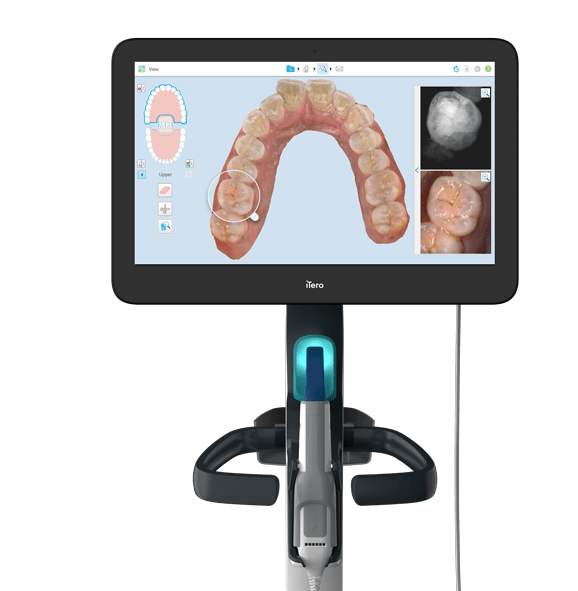 How does Invisalign® treatment work?